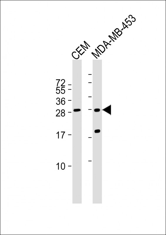 All lanes : Anti-IFI6 Antibody (N-term) at 1:1000 dilution Lane 1: CEM whole cell lysate Lane 2: MDA-MB-453 whole cell lysate Lysates/proteins at 20 µg per lane. Secondary Goat Anti-Rabbit IgG, (H+L), Peroxidase conjugated at 1/10000 dilution. Predicted band size : 13 kDa Blocking/Dilution buffer: 5% NFDM/TBST.