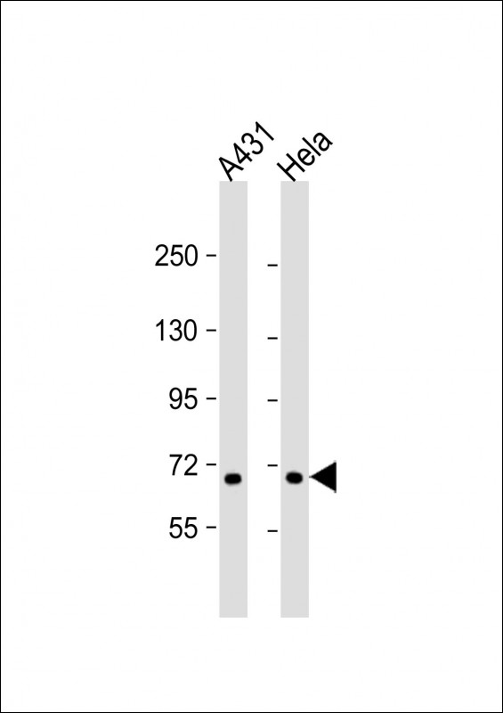 All lanes : Anti-CCDC120 Antibody (N-term) at 1:1000 dilution Lane 1: A431 whole cell lysate Lane 2: Hela whole cell lysate Lysates/proteins at 20 µg per lane. Secondary Goat Anti-Rabbit IgG, (H+L), Peroxidase conjugated at 1/10000 dilution. Predicted band size : 68 kDa Blocking/Dilution buffer: 5% NFDM/TBST.