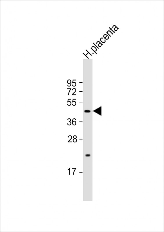 Anti-SGPP1 Antibody (N-term) at 1:1000 dilution + human placenta lysate Lysates/proteins at 20 µg per lane. Secondary Goat Anti-Rabbit IgG, (H+L), Peroxidase conjugated at 1/10000 dilution. Predicted band size : 49 kDa Blocking/Dilution buffer: 5% NFDM/TBST.