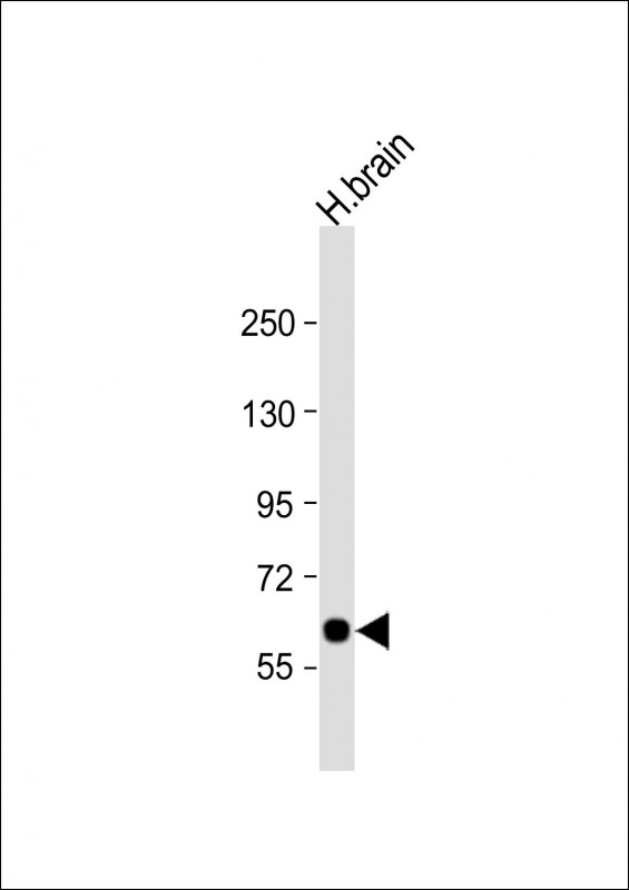 Anti-SLC2A13 Antibody (Center) at 1:1000 dilution + human brain lysate Lysates/proteins at 20 µg per lane. Secondary Goat Anti-Rabbit IgG, (H+L), Peroxidase conjugated at 1/10000 dilution. Predicted band size : 70 kDa Blocking/Dilution buffer: 5% NFDM/TBST.