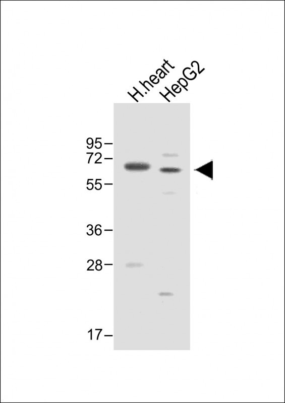All lanes : Anti-ASPG Antibody (Center) at 1:1000 dilution Lane 1: Human heart lysate Lane 2: HepG2 whole cell lysate Lysates/proteins at 20 µg per lane. Secondary Goat Anti-Rabbit IgG, (H+L), Peroxidase conjugated at 1/10000 dilution. Predicted band size : 61 kDa Blocking/Dilution buffer: 5% NFDM/TBST.