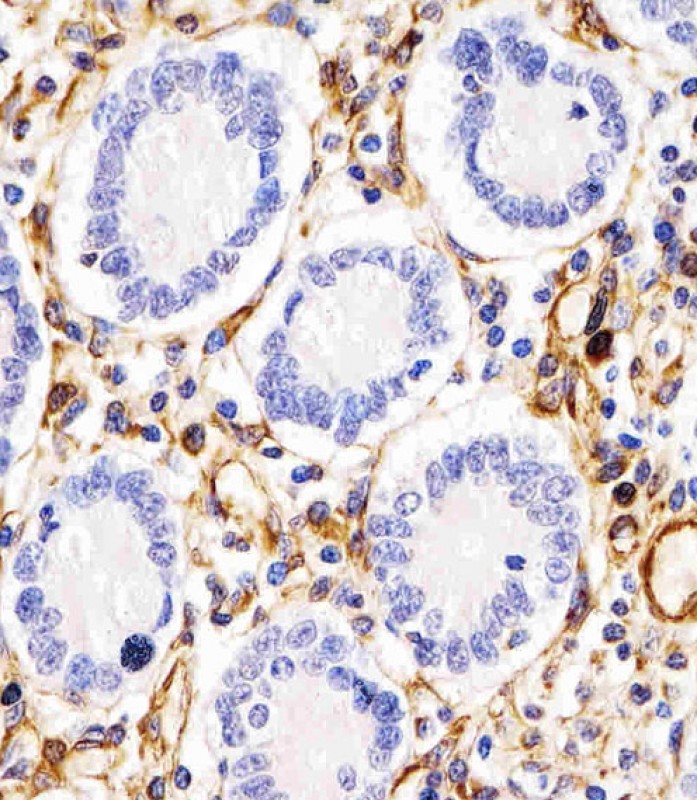 AP13588a staining RHBDF2 in human duodenum tissue sections by Immunohistochemistry (IHC-P - paraformaldehyde-fixed, paraffin-embedded sections). Tissue was fixed with formaldehyde and blocked with 3% BSA for 0. 5 hour at room temperature; antigen retrieval was by heat mediation with a citrate buffer (pH6). Samples were incubated with primary antibody (1/25) for 1 hours at 37°C. A undiluted biotinylated goat polyvalent antibody was used as the secondary antibody.