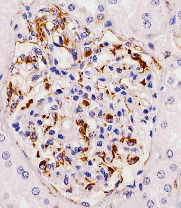 AP13588a staining RHBDF2 in human kidney tissue sections by Immunohistochemistry (IHC-P - paraformaldehyde-fixed, paraffin-embedded sections). Tissue was fixed with formaldehyde and blocked with 3% BSA for 0. 5 hour at room temperature; antigen retrieval was by heat mediation with a citrate buffer (pH6). Samples were incubated with primary antibody (1/25) for 1 hours at 37°C. A undiluted biotinylated goat polyvalent antibody was used as the secondary antibody.