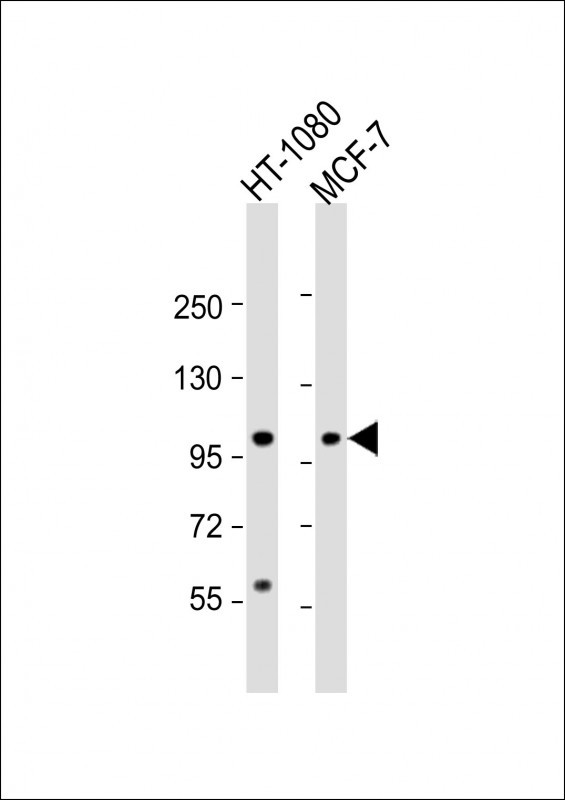 All lanes : Anti-RHBDF2 Antibody (N-term) at 1:2000 dilution Lane 1: HT-1080 whole cell lysate Lane 2: MCF-7 whole cell lysate Lysates/proteins at 20 µg per lane. Secondary Goat Anti-Rabbit IgG, (H+L), Peroxidase conjugated at 1/10000 dilution. Predicted band size : 97 kDa Blocking/Dilution buffer: 5% NFDM/TBST.