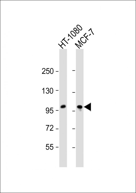 All lanes : Anti-RHBDF2 Antibody (N-term) at 1:2000 dilution Lane 1: HT-1080 whole cell lysate Lane 2: MCF-7 whole cell lysate Lysates/proteins at 20 µg per lane. Secondary Goat Anti-Rabbit IgG, (H+L), Peroxidase conjugated at 1/10000 dilution. Predicted band size : 97 kDa Blocking/Dilution buffer: 5% NFDM/TBST.