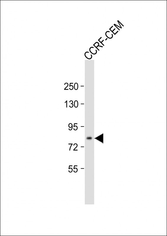 Anti-ADAM11 Antibody (N-term) at 1:500 dilution + CCRF-CEM whole cell lysate Lysates/proteins at 20 µg per lane. Secondary Goat Anti-Rabbit IgG, (H+L), Peroxidase conjugated at 1/10000 dilution. Predicted band size : 83 kDa Blocking/Dilution buffer: 5% NFDM/TBST.
