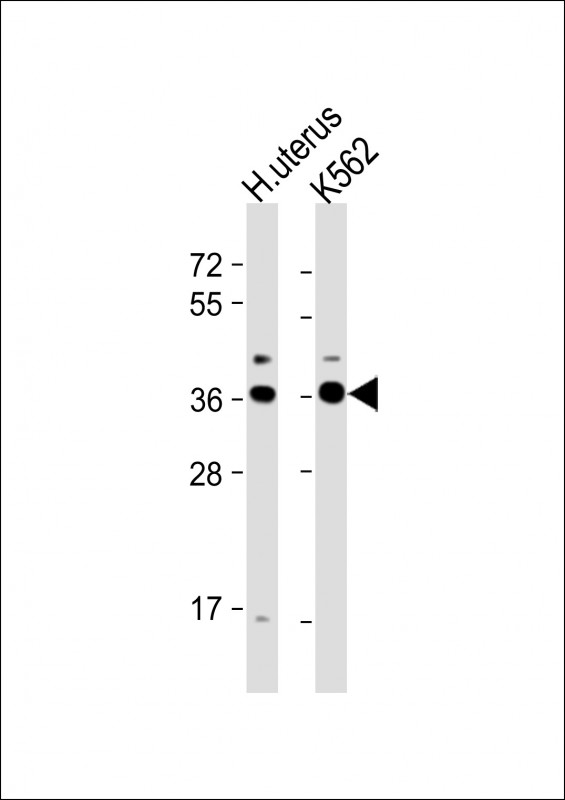 All lanes : Anti-OR52H1 Antibody (C-term) at 1:1000 dilution Lane 1: human uterus lysate Lane 2: K562 whole cell lysate Lysates/proteins at 20 µg per lane. Secondary Goat Anti-Rabbit IgG, (H+L), Peroxidase conjugated at 1/10000 dilution. Predicted band size : 36 kDa Blocking/Dilution buffer: 5% NFDM/TBST.