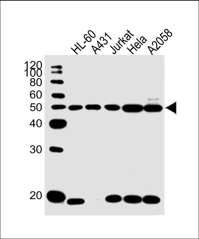 All lanes : Anti-KRT28 Antibody (C-term) at 1:1000 dilution Lane 1: HL-60 whole cell lysate Lane 2: A431 whole cell lysate Lane 3: Jurkat whole cell lysate Lane 4: Hela whole cell lysate Lane 5: A2058 whole cell lysate Lysates/proteins at 20 µg per lane. Secondary Goat Anti-Rabbit IgG, (H+L), Peroxidase conjugated at 1/10000 dilution. Predicted band size : 51 kDa Blocking/Dilution buffer: 5% NFDM/TBST.