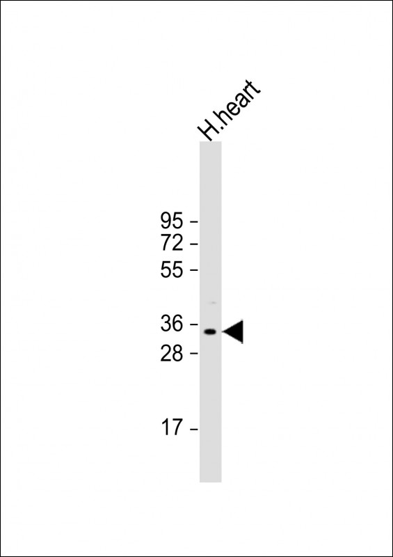 Anti-PLEKHF1 Antibody (N-term) at 1:1000 dilution + human heart lysate Lysates/proteins at 20 µg per lane. Secondary Goat Anti-Rabbit IgG, (H+L), Peroxidase conjugated at 1/10000 dilution. Predicted band size : 31 kDa Blocking/Dilution buffer: 5% NFDM/TBST.