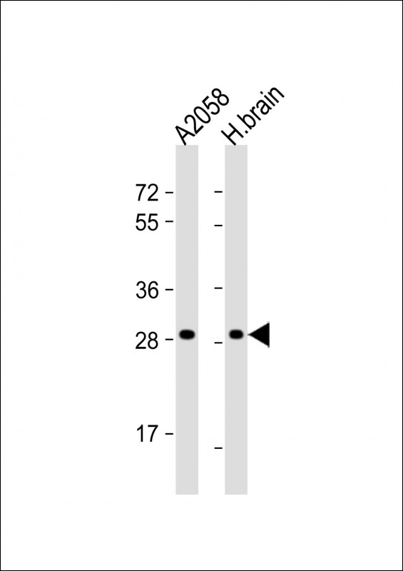 All lanes : Anti-OR4F17 Antibody (N-term) at 1:1000 dilution Lane 1: A2058 whole cell lysate Lane 2: human brain lysate Lysates/proteins at 20 µg per lane. Secondary Goat Anti-Rabbit IgG, (H+L), Peroxidase conjugated at 1/10000 dilution. Predicted band size : 34 kDa Blocking/Dilution buffer: 5% NFDM/TBST.