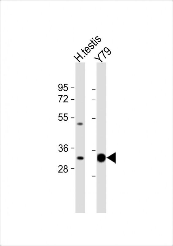 All lanes : Anti-ELOVL4 Antibody (C-term) at 1:1000 dilution Lane 1: human testis lysate Lane 2: Y79 whole cell lysate Lysates/proteins at 20 µg per lane. Secondary Goat Anti-Rabbit IgG, (H+L), Peroxidase conjugated at 1/10000 dilution. Predicted band size : 37 kDa Blocking/Dilution buffer: 5% NFDM/TBST.
