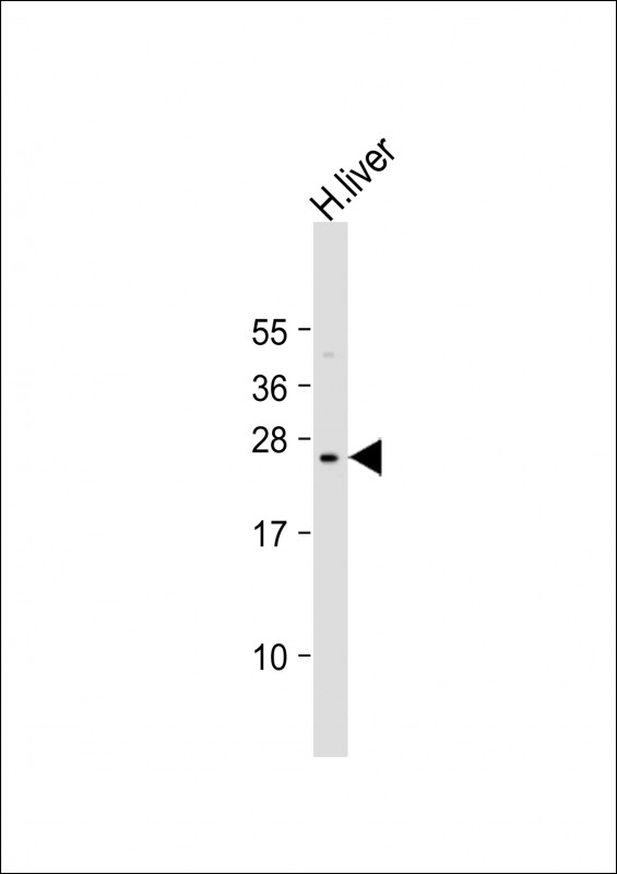 Anti-PTTG2 Antibody (Center) at 1:2000 dilution + human liver lysate Lysates/proteins at 20 µg per lane. Secondary Goat Anti-Rabbit IgG, (H+L), Peroxidase conjugated at 1/10000 dilution. Predicted band size : 22 kDa Blocking/Dilution buffer: 5% NFDM/TBST.