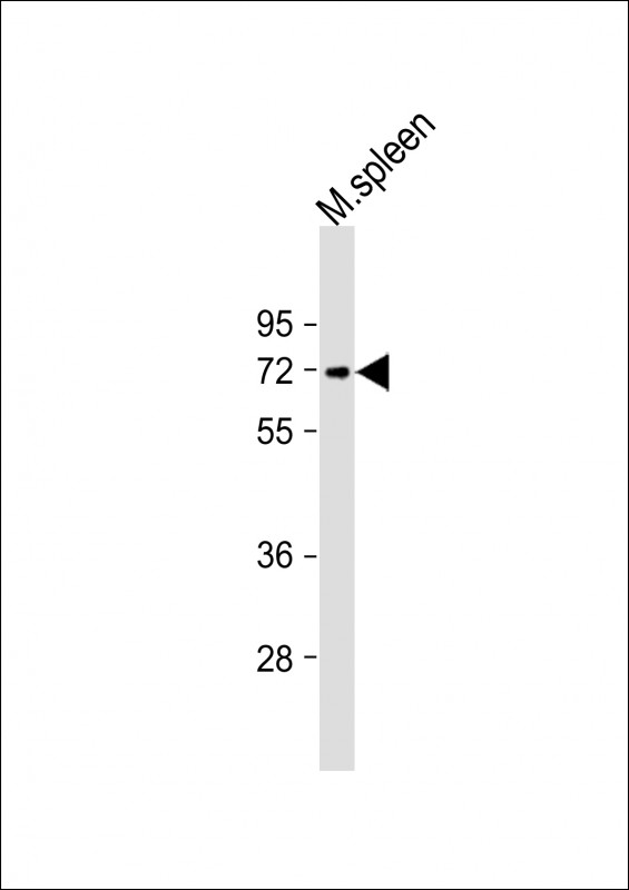 Anti-Mouse Tgfbr2 Antibody (C-term) at 1:1000 dilution + mouse spleen lysate Lysates/proteins at 20 µg per lane. Secondary Goat Anti-Rabbit IgG, (H+L), Peroxidase conjugated at 1/10000 dilution. Predicted band size : 67 kDa Blocking/Dilution buffer: 5% NFDM/TBST.