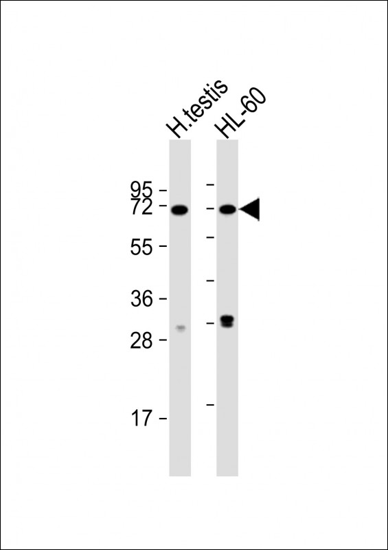All lanes : Anti-CCIN Antibody (Center) at 1:1000 dilution Lane 1: human testis lysate Lane 2: HL-60 whole cell lysate Lysates/proteins at 20 µg per lane. Secondary Goat Anti-Rabbit IgG, (H+L), Peroxidase conjugated at 1/10000 dilution. Predicted band size : 67 kDa Blocking/Dilution buffer: 5% NFDM/TBST.