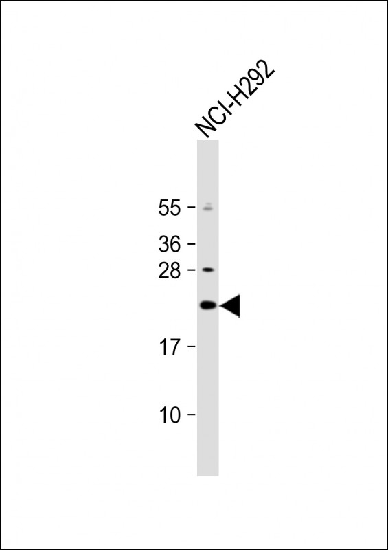 Anti-DNAJC5G Antibody (Center) at 1:1000 dilution + NCI-H292 whole cell lysate Lysates/proteins at 20 µg per lane. Secondary Goat Anti-Rabbit IgG, (H+L), Peroxidase conjugated at 1/10000 dilution. Predicted band size : 21 kDa Blocking/Dilution buffer: 5% NFDM/TBST.