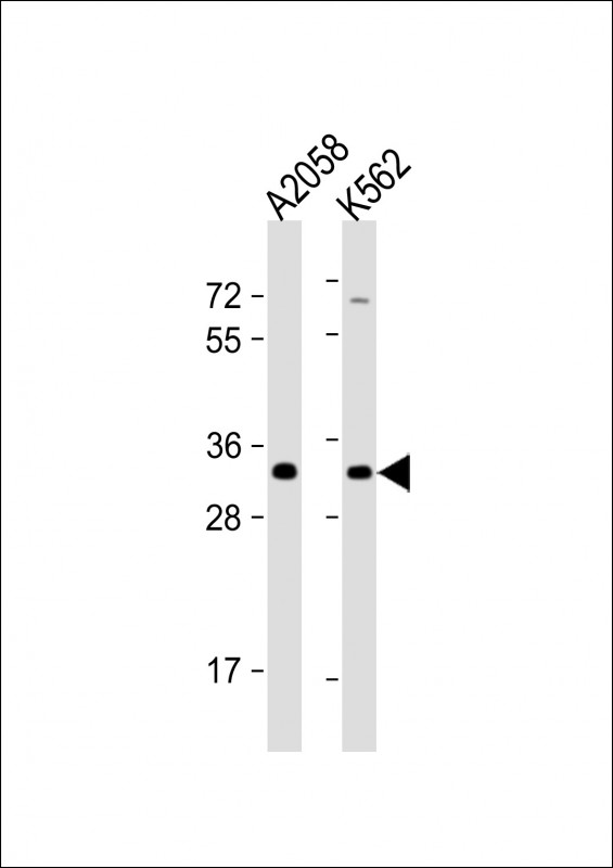 All lanes : Anti-OR8J3 Antibody (C-term) at 1:1000 dilution Lane 1: A2058 whole cell lysate Lane 2: K562 whole cell lysate Lysates/proteins at 20 µg per lane. Secondary Goat Anti-Rabbit IgG, (H+L), Peroxidase conjugated at 1/10000 dilution. Predicted band size : 35 kDa Blocking/Dilution buffer: 5% NFDM/TBST.