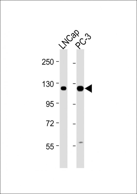 All lanes : Anti-DSPP Antibody (N-term) at 1:2000 dilution Lane 1: LNCap whole cell lysate Lane 2: PC-3 whole cell lysate Lysates/proteins at 20 µg per lane. Secondary Goat Anti-Rabbit IgG, (H+L), Peroxidase conjugated at 1/10000 dilution. Predicted band size : 131 kDa Blocking/Dilution buffer: 5% NFDM/TBST.