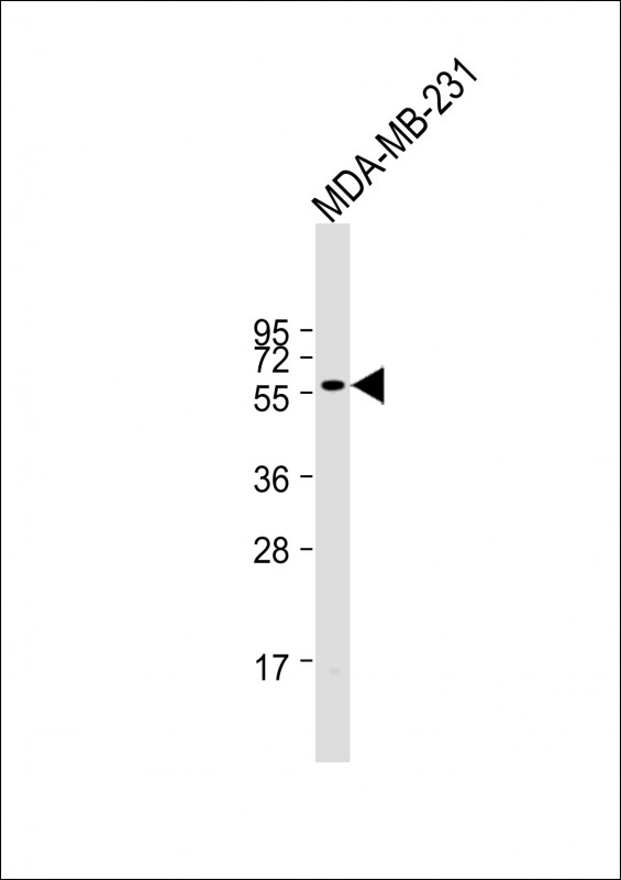 Anti-ONECUT3 Antibody (C-term) at 1:1000 dilution + MDA-MB-231 whole cell lysate Lysates/proteins at 20 µg per lane. Secondary Goat Anti-Rabbit IgG, (H+L), Peroxidase conjugated at 1/10000 dilution. Predicted band size : 50 kDa Blocking/Dilution buffer: 5% NFDM/TBST.