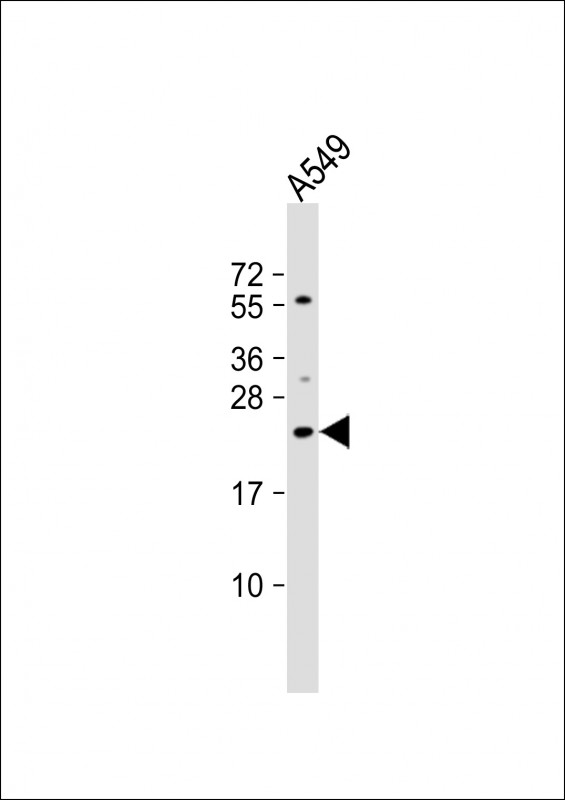 Anti-ECSCR Antibody (C-term) at 1:1000 dilution + A549 whole cell lysate Lysates/proteins at 20 µg per lane. Secondary Goat Anti-Rabbit IgG, (H+L), Peroxidase conjugated at 1/10000 dilution. Predicted band size : 21 kDa Blocking/Dilution buffer: 5% NFDM/TBST.