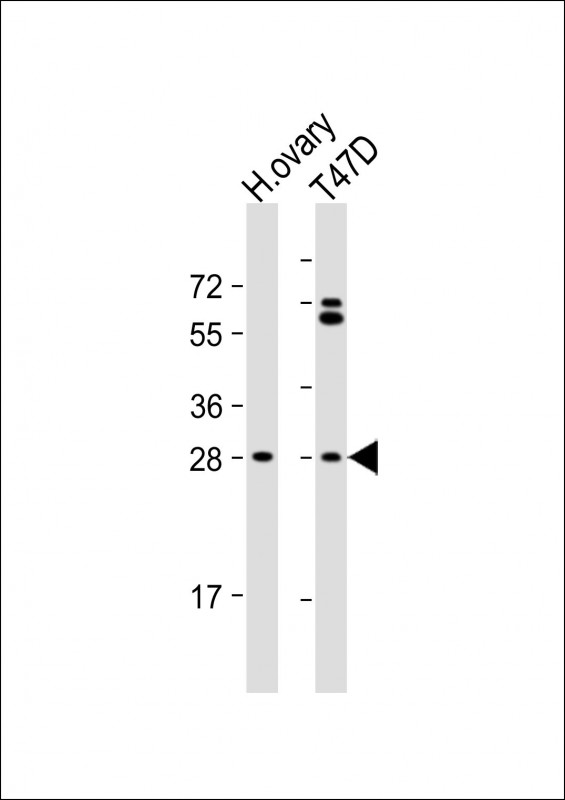 All lanes : Anti-FIGLA Antibody (Center) at 1:1000 dilution Lane 1: human ovary lysate Lane 2: T47D whole cell lysate Lysates/proteins at 20 µg per lane. Secondary Goat Anti-Rabbit IgG, (H+L), Peroxidase conjugated at 1/10000 dilution. Predicted band size : 24 kDa Blocking/Dilution buffer: 5% NFDM/TBST.