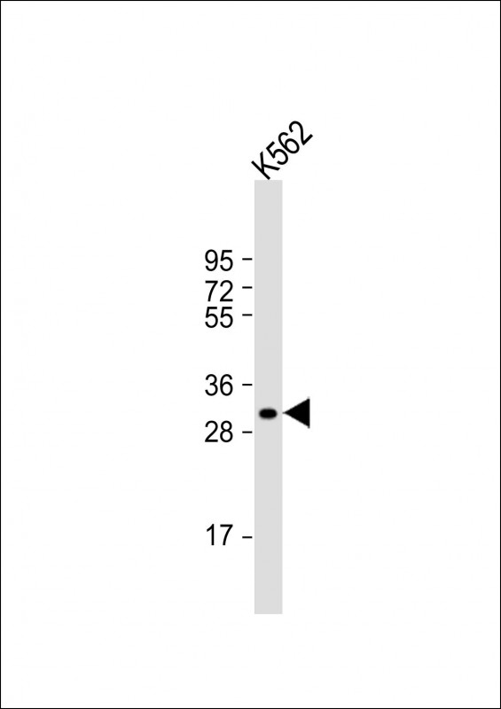 Anti-NKX6-2 Antibody (N-term) at 1:1000 dilution + K562 whole cell lysate Lysates/proteins at 20 µg per lane. Secondary Goat Anti-Rabbit IgG, (H+L), Peroxidase conjugated at 1/10000 dilution. Predicted band size : 29 kDa Blocking/Dilution buffer: 5% NFDM/TBST.