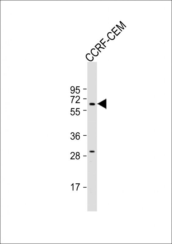 Anti-DYTN Antibody (C-term) at 1:500 dilution + CCRF-CEM whole cell lysate Lysates/proteins at 20 µg per lane. Secondary Goat Anti-Rabbit IgG, (H+L), Peroxidase conjugated at 1/10000 dilution. Predicted band size : 65 kDa Blocking/Dilution buffer: 5% NFDM/TBST.