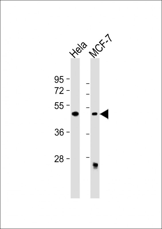 All lanes : Anti-ALKBH5 Antibody (Center) at 1:500 dilution Lane 1: Hela whole cell lysate Lane 2: MCF-7 whole cell lysate Lysates/proteins at 20 µg per lane. Secondary Goat Anti-Rabbit IgG, (H+L), Peroxidase conjugated at 1/10000 dilution. Predicted band size : 44 kDa Blocking/Dilution buffer: 5% NFDM/TBST.