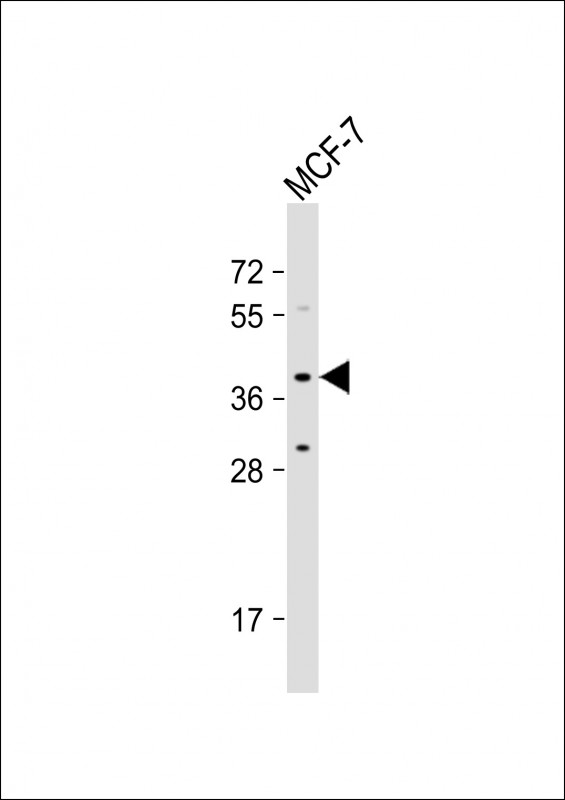 Anti-OR4X1 Antibody (N-term) at 1:1000 dilution + MCF-7 whole cell lysate Lysates/proteins at 20 µg per lane. Secondary Goat Anti-Rabbit IgG, (H+L), Peroxidase conjugated at 1/10000 dilution. Predicted band size : 34 kDa Blocking/Dilution buffer: 5% NFDM/TBST.
