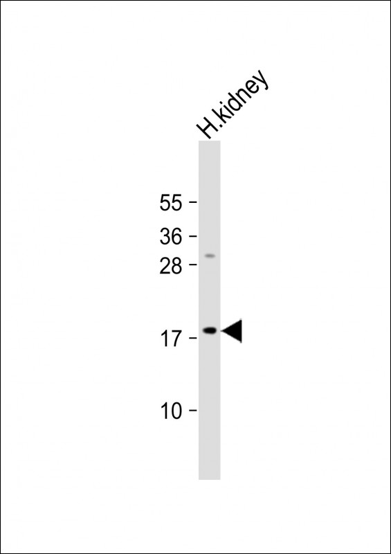 Anti-LYZL1 Antibody (C-term) at 1:1000 dilution + human kidney lysate Lysates/proteins at 20 µg per lane. Secondary Goat Anti-Rabbit IgG, (H+L), Peroxidase conjugated at 1/10000 dilution. Predicted band size : 17 kDa Blocking/Dilution buffer: 5% NFDM/TBST.