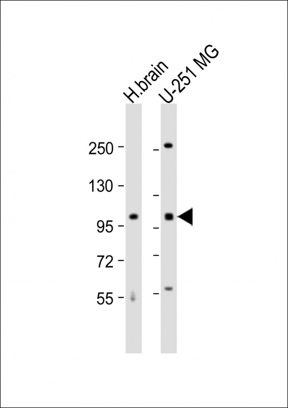 All lanes : Anti-MBD6 Antibody (C-term) at 1:1000 dilution Lane 1: human brain lysate Lane 2: U-251 MG whole cell lysate Lysates/proteins at 20 µg per lane. Secondary Goat Anti-Rabbit IgG, (H+L), Peroxidase conjugated at 1/10000 dilution. Predicted band size : 101 kDa Blocking/Dilution buffer: 5% NFDM/TBST.