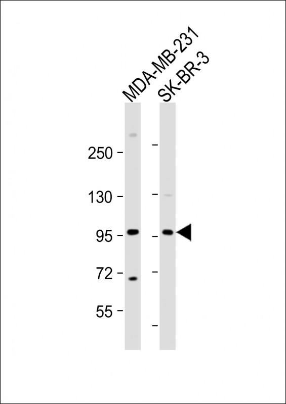 All lanes : Anti-TCHHL1 Antibody (N-term) at 1:1000 dilution Lane 1: MDA-MB-231 whole cell lysate Lane 2: SK-BR-3 whole cell lysate Lysates/proteins at 20 µg per lane. Secondary Goat Anti-Rabbit IgG, (H+L), Peroxidase conjugated at 1/10000 dilution. Predicted band size : 99 kDa Blocking/Dilution buffer: 5% NFDM/TBST.