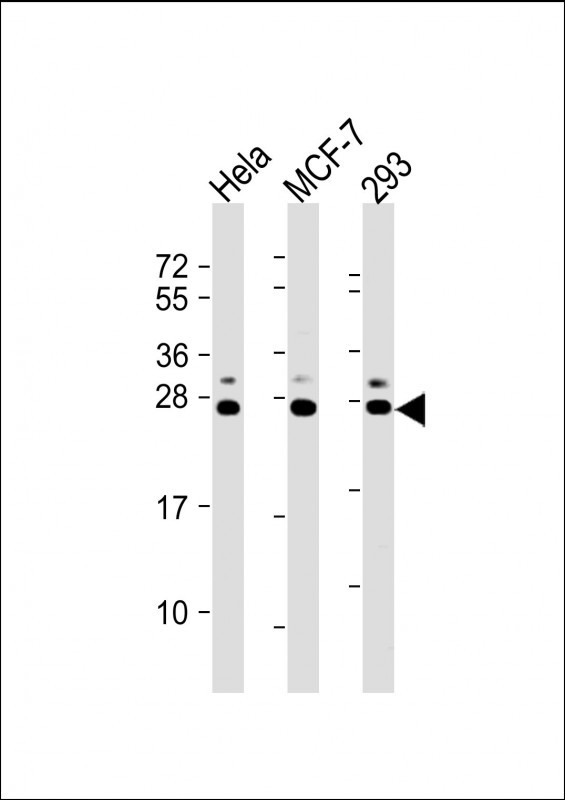 All lanes : Anti-KDELR1 Antibody (C-term) at 1:2000 dilution Lane 1: Hela whole cell lysate Lane 2: MCF-7 whole cell lysate Lane 3: 293 whole cell lysate Lysates/proteins at 20 µg per lane. Secondary Goat Anti-Rabbit IgG, (H+L), Peroxidase conjugated at 1/10000 dilution. Predicted band size : 25 kDa Blocking/Dilution buffer: 5% NFDM/TBST.