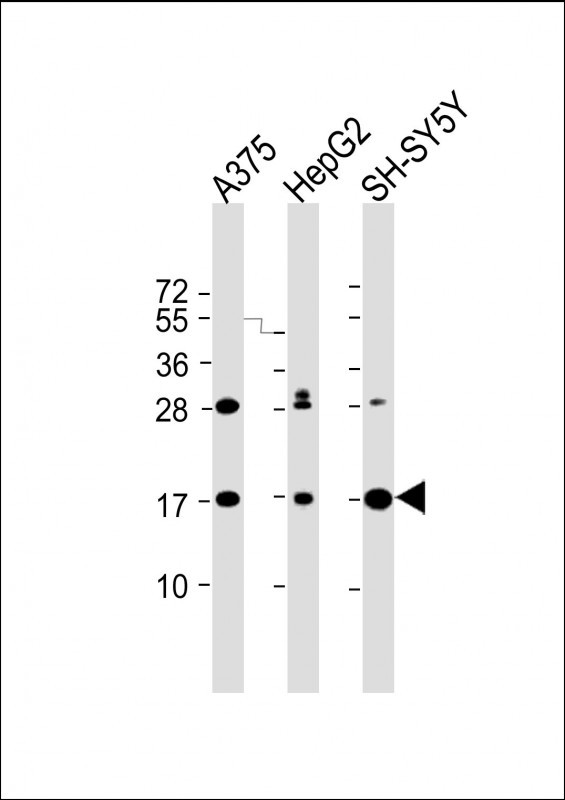 All lanes : Anti-SRP14 Antibody (Center) at 1:2000 dilution Lane 1: A375 whole cell lysate Lane 2: HepG2 whole cell lysate Lane 3: SH-SY5Y whole cell lysate Lysates/proteins at 20 µg per lane. Secondary Goat Anti-Rabbit IgG, (H+L), Peroxidase conjugated at 1/10000 dilution. Predicted band size : 15 kDa Blocking/Dilution buffer: 5% NFDM/TBST.