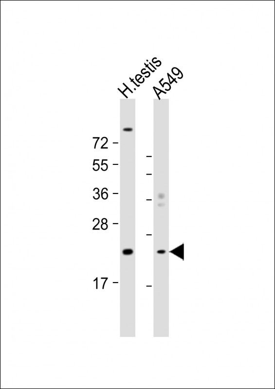 All lanes : Anti-HSPB9 Antibody (Center) at 1:1000 dilution Lane 1: human testis lysate Lane 2: A549 whole cell lysate Lysates/proteins at 20 µg per lane. Secondary Goat Anti-Rabbit IgG, (H+L), Peroxidase conjugated at 1/10000 dilution. Predicted band size : 17 kDa Blocking/Dilution buffer: 5% NFDM/TBST.