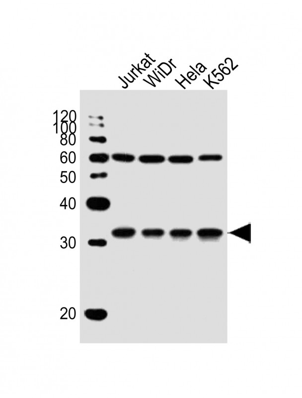 All lanes : Anti-EXOSC6 Antibody (N-term) at 1:1000 dilution Lane 1: Jurkat whole cell lysate Lane 2: WiDr whole cell lysate Lane 3: Hela whole cell lysate Lane 4: K562 whole cell lysate Lysates/proteins at 20 µg per lane. Secondary Goat Anti-Rabbit IgG, (H+L), Peroxidase conjugated at 1/10000 dilution. Predicted band size : 28 kDa Blocking/Dilution buffer: 5% NFDM/TBST.