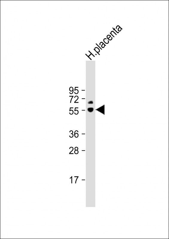 Anti-PSG6 Antibody (N-term) at 1:1000 dilution + human placenta lysate Lysates/proteins at 20 µg per lane. Secondary Goat Anti-Rabbit IgG, (H+L), Peroxidase conjugated at 1/10000 dilution. Predicted band size : 49 kDa Blocking/Dilution buffer: 5% NFDM/TBST.