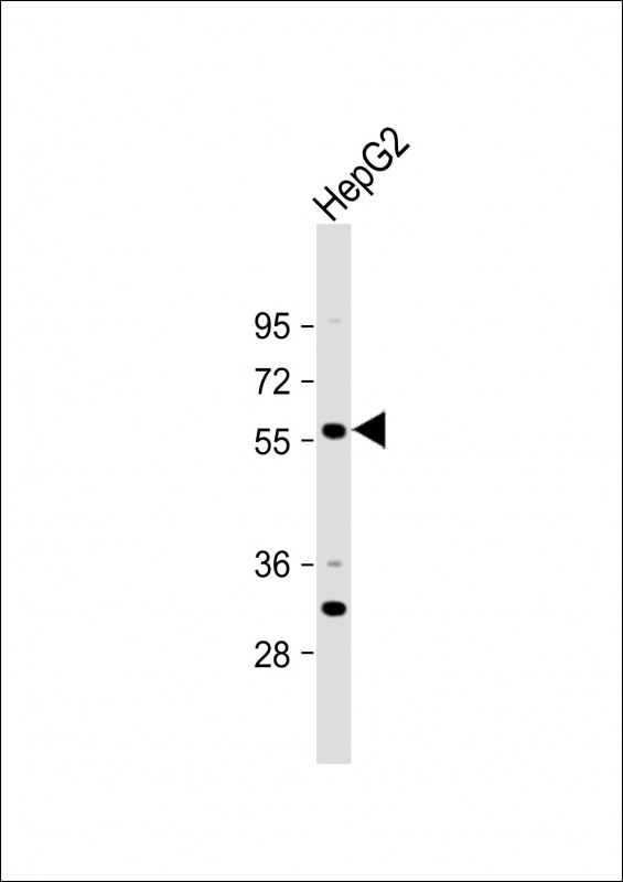 Anti-ST6GAL2 Antibody (C-term) at 1:1000 dilution + HepG2 whole cell lysate Lysates/proteins at 20 µg per lane. Secondary Goat Anti-Rabbit IgG, (H+L), Peroxidase conjugated at 1/10000 dilution. Predicted band size : 60 kDa Blocking/Dilution buffer: 5% NFDM/TBST.