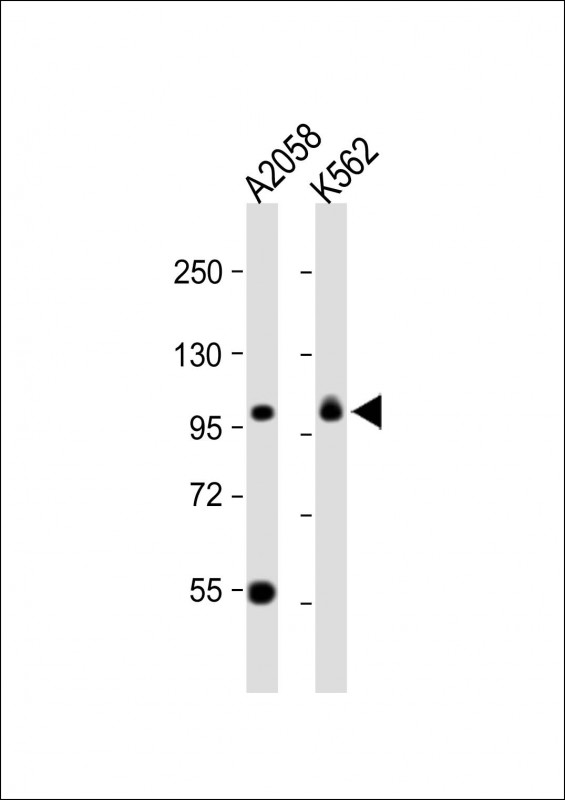 All lanes : Anti-COPG Antibody (C-term) at 1:1000 dilution Lane 1: A2058 whole cell lysate Lane 2: K562 whole cell lysate Lysates/proteins at 20 µg per lane. Secondary Goat Anti-Rabbit IgG, (H+L), Peroxidase conjugated at 1/10000 dilution. Predicted band size : 98 kDa Blocking/Dilution buffer: 5% NFDM/TBST.