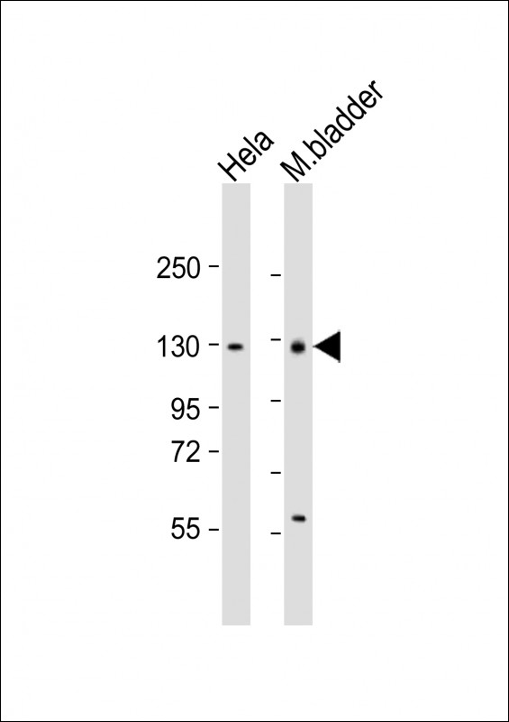 All lanes : Anti-Enpp1 Antibody (N-term) at 1:1000 dilution Lane 1: Hela whole cell lysate Lane 2: mouse bladder lysate Lysates/proteins at 20 µg per lane. Secondary Goat Anti-Rabbit IgG, (H+L), Peroxidase conjugated at 1/10000 dilution. Predicted band size : 103 kDa Blocking/Dilution buffer: 5% NFDM/TBST.