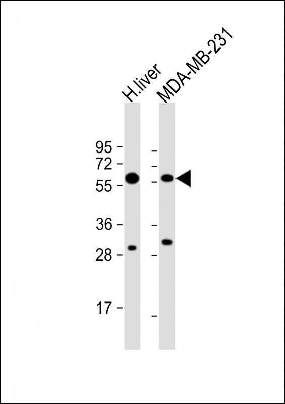 All lanes : Anti-UGT2B4 Antibody (N-term) at 1:8000 dilution Lane 1: human liver lysate Lane 2: MDA-MB-231 whole cell lysate Lysates/proteins at 20 µg per lane. Secondary Goat Anti-Rabbit IgG, (H+L), Peroxidase conjugated at 1/10000 dilution. Predicted band size : 61 kDa Blocking/Dilution buffer: 5% NFDM/TBST.