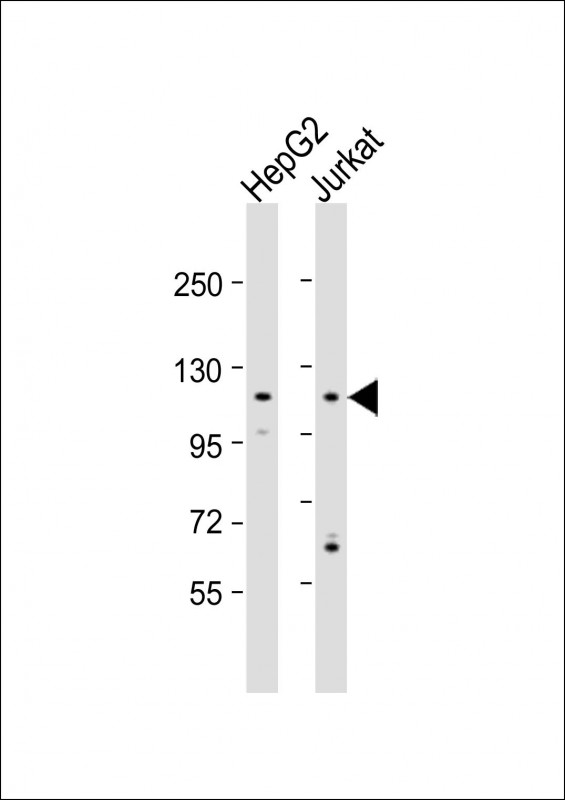 All lanes : Anti-MAN2C1 Antibody (N-term) at 1:1000 dilution Lane 1: HepG2 whole cell lysate Lane 2: Jurkat whole cell lysate Lysates/proteins at 20 µg per lane. Secondary Goat Anti-Rabbit IgG, (H+L), Peroxidase conjugated at 1/10000 dilution. Predicted band size : 116 kDa Blocking/Dilution buffer: 5% NFDM/TBST.