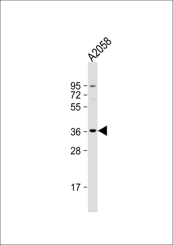 Anti-OR52J3 Antibody (C-term) at 1:1000 dilution + A2058 whole cell lysate Lysates/proteins at 20 µg per lane. Secondary Goat Anti-Rabbit IgG, (H+L), Peroxidase conjugated at 1/10000 dilution. Predicted band size : 35 kDa Blocking/Dilution buffer: 5% NFDM/TBST.