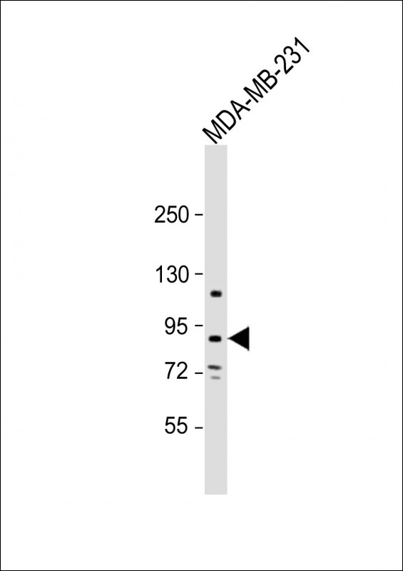 Anti-TROAP Antibody (N-term) at 1:1000 dilution + MDA-MB-231 whole cell lysate Lysates/proteins at 20 µg per lane. Secondary Goat Anti-Rabbit IgG, (H+L), Peroxidase conjugated at 1/10000 dilution. Predicted band size : 84 kDa Blocking/Dilution buffer: 5% NFDM/TBST.