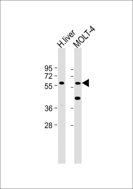 All lanes : Anti-GLT8D4 Antibody (C-term) at 1:2000 dilution Lane 1: Human liver lysate Lane 2: MOLT-4 whole cell lysate Lysates/proteins at 20 µg per lane. Secondary Goat Anti-Rabbit IgG, (H+L), Peroxidase conjugated at 1/10000 dilution. Predicted band size : 51 kDa Blocking/Dilution buffer: 5% NFDM/TBST.