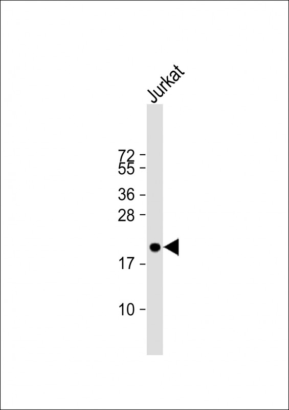 Anti-APOBEC3A Antibody (N-term) at 1:1000 dilution + Jurkat whole cell lysate Lysates/proteins at 20 µg per lane. Secondary Goat Anti-Rabbit IgG, (H+L), Peroxidase conjugated at 1/10000 dilution. Predicted band size : 23 kDa Blocking/Dilution buffer: 5% NFDM/TBST.