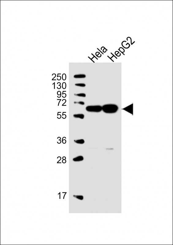 All lanes : Anti-UTP6 Antibody (N-term) at 1:1000 dilution Lane 1: Hela whole cell lysate Lane 2: HepG2 whole cell lysate Lysates/proteins at 20 µg per lane. Secondary Goat Anti-Rabbit IgG, (H+L), Peroxidase conjugated at 1/10000 dilution. Predicted band size : 70 kDa Blocking/Dilution buffer: 5% NFDM/TBST.