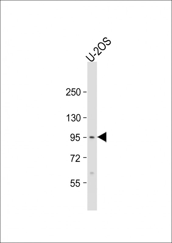 Anti-EPC2 Antibody (N-term) at 1:1000 dilution + U-2OS whole cell lysate Lysates/proteins at 20 µg per lane. Secondary Goat Anti-Rabbit IgG, (H+L), Peroxidase conjugated at 1/10000 dilution. Predicted band size : 91 kDa Blocking/Dilution buffer: 5% NFDM/TBST.