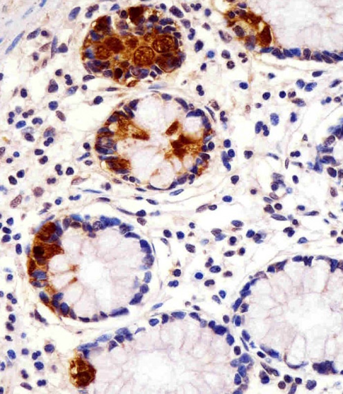 AP5606C staining REG3G in human small intestine sections by Immunohistochemistry (IHC-P - paraformaldehyde-fixed, paraffin-embedded sections). Tissue was fixed with formaldehyde and blocked with 3% BSA for 0. 5 hour at room temperature; antigen retrieval was by heat mediation with a citrate buffer (pH6). Samples were incubated with primary antibody (1/25) for 1 hours at 37°C. A undiluted biotinylated goat polyvalent antibody was used as the secondary antibody.