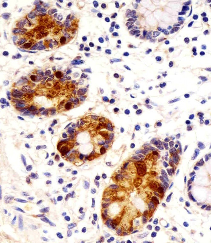 AP5606C staining REG3G in human small intestine sections by Immunohistochemistry (IHC-P - paraformaldehyde-fixed, paraffin-embedded sections). Tissue was fixed with formaldehyde and blocked with 3% BSA for 0. 5 hour at room temperature; antigen retrieval was by heat mediation with a citrate buffer (pH6). Samples were incubated with primary antibody (1/25) for 1 hours at 37°C. A undiluted biotinylated goat polyvalent antibody was used as the secondary antibody.