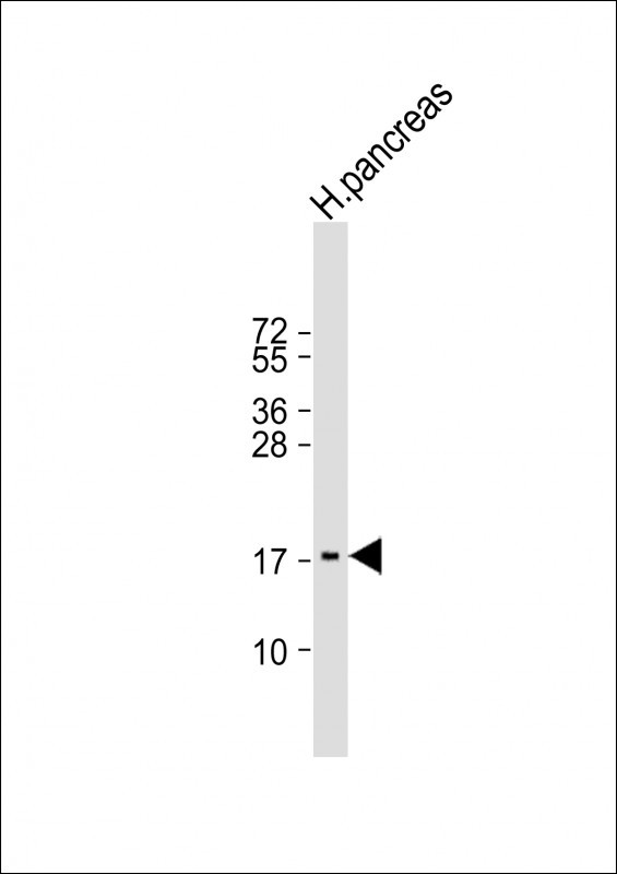 Anti-REG3G Antibody (Center) at 1:2000 dilution + human pancreas lysate Lysates/proteins at 20 µg per lane. Secondary Goat Anti-Rabbit IgG, (H+L), Peroxidase conjugated at 1/10000 dilution. Predicted band size : 19 kDa Blocking/Dilution buffer: 5% NFDM/TBST.